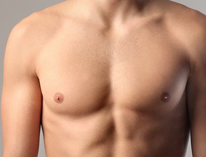 Revisional Gynecomastia Surgery